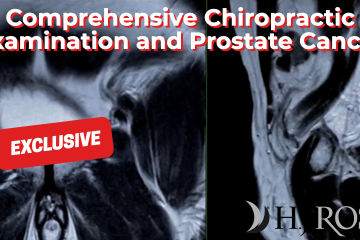 Comprehensive Chiropractic Examination and Prostate Cancer